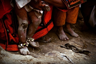 Rada Akbar, The tiny feet experience big harsh
