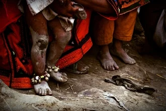 Photo art showing tiny feet exploring rough surfaces.