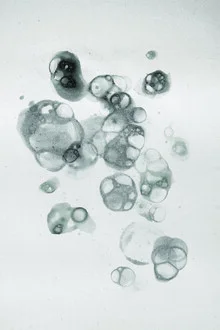 Abstrakte Illustration in Schwarz mit sanften Blasenmotiven